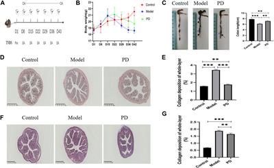Network Pharmacology-Based Strategy to Identify the Pharmacological Mechanisms of Pulsatilla Decoction against Crohn’s Disease